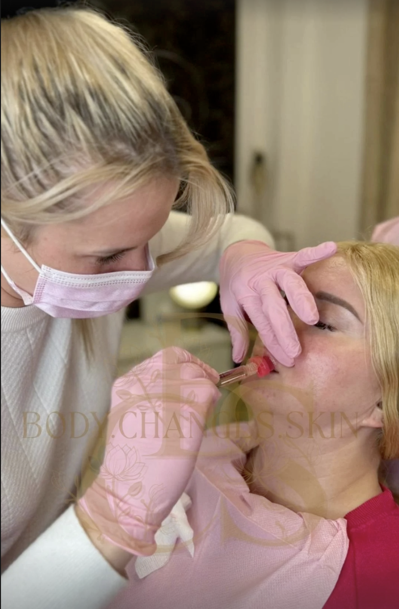 Microneedling behandeling